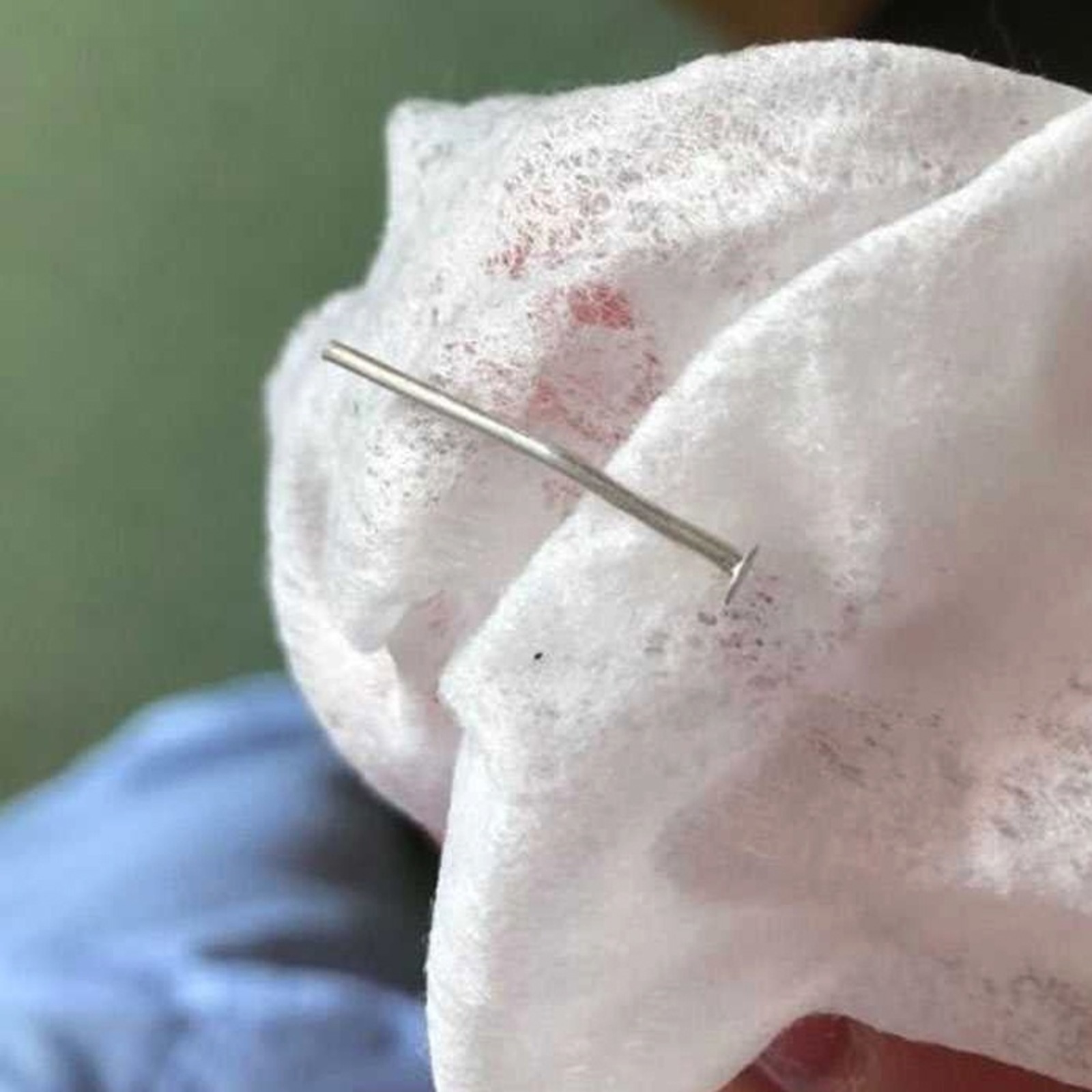 В Башкирии годовалая девочка проглотила гвозди